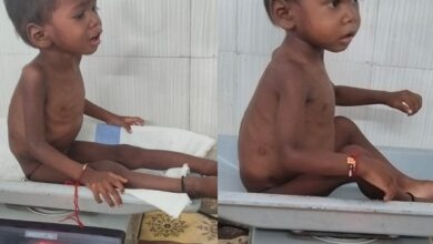 Moving from malnutrition to good nutrition: Children are finding a new lease of life at the Ambikapur NRC.