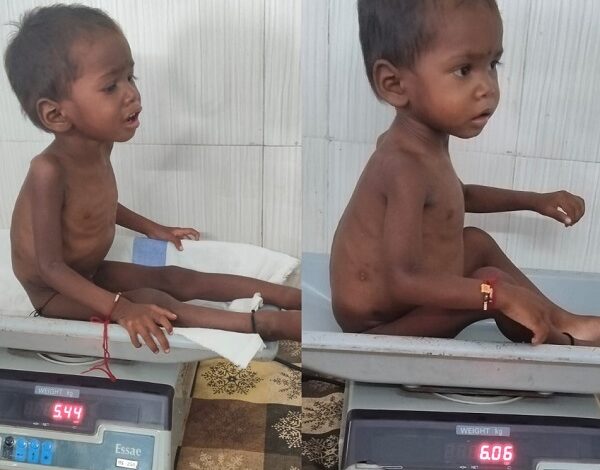 Moving from malnutrition to good nutrition: Children are finding a new lease of life at the Ambikapur NRC.